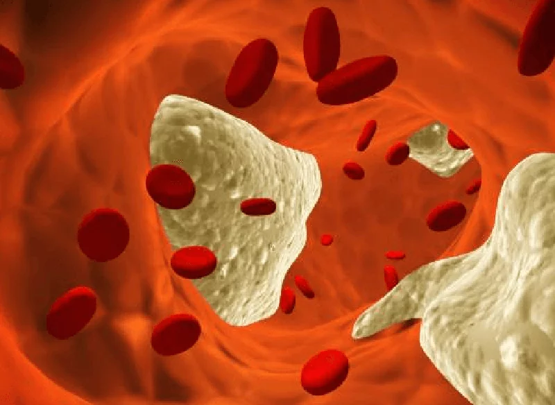 Cholesterol in blood